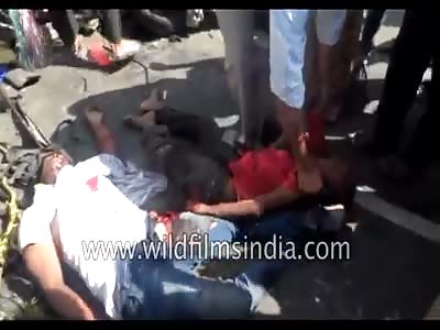 Graphic warning: 5 dead as a car gets crushed between two lorries in Hyderabad 