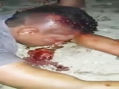 Thief lynched by angry mob in Brazil
