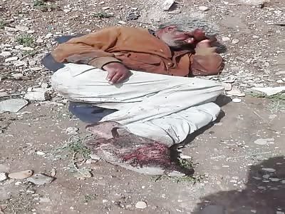 homeless tunisian old man with very nasty rotten legs