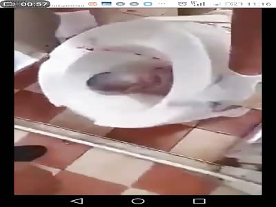 abandoned newborn baby stuck in toilet still alive