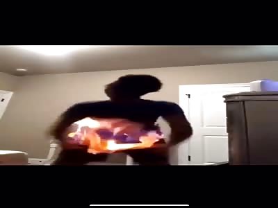 burning ass