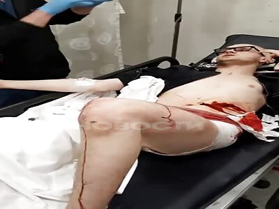 Russian man stabbed by ukranian in Istanbul 