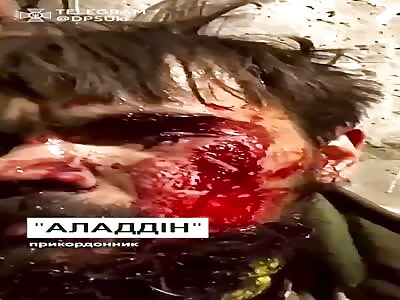 Wounded Ukrainian soldier film himself after battle 