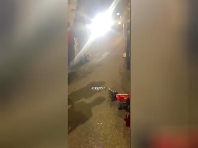 Motorcyclist with open fracture in brutal accident 