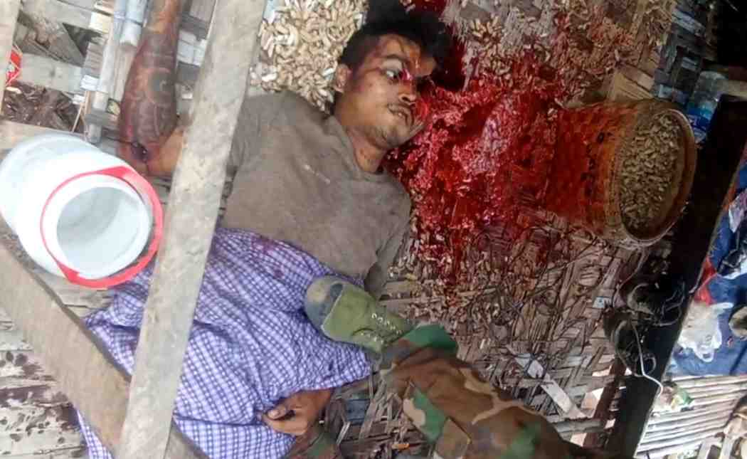 Leave Him Alone, He Is Dead AF