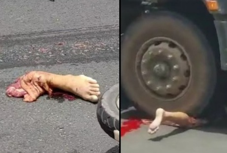 Pedestrian gored by heavy truck 