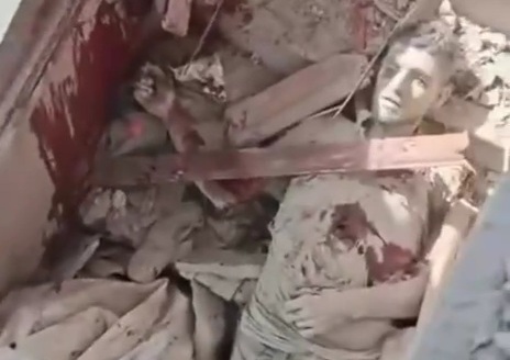 AFTERMATH OF ISRAELI AIRSTRIKE ON HOSPITAL IN GAZA 