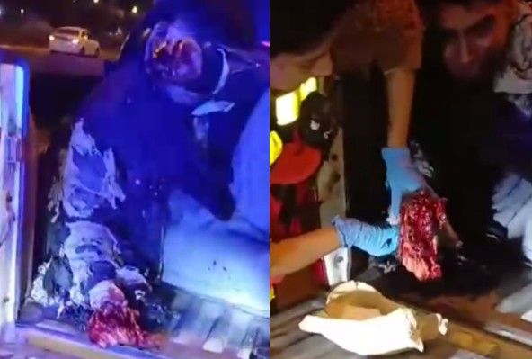 Extortionist Lost Hand Following Dynamite Explosion , Peru