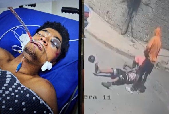 Man In Coma After Being Attacked With Bat During Road Rage