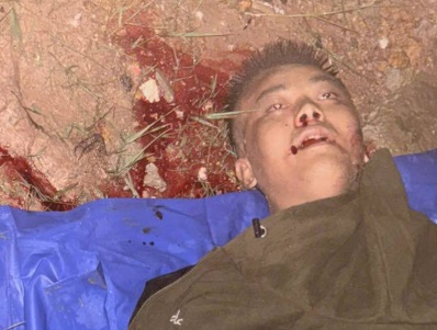 [LAST GASPS OF AIR]Vietnamese man vrashef dead by speeding car 