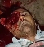 Man Killed by Gunshot to  Eye