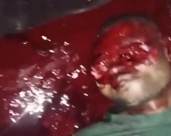 EYE member killed and his eyes gouged out by BLACK AXE GANG MEMBERS