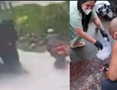 Paramedics Collect Biker’s Brain After He Was Crushed by Truck