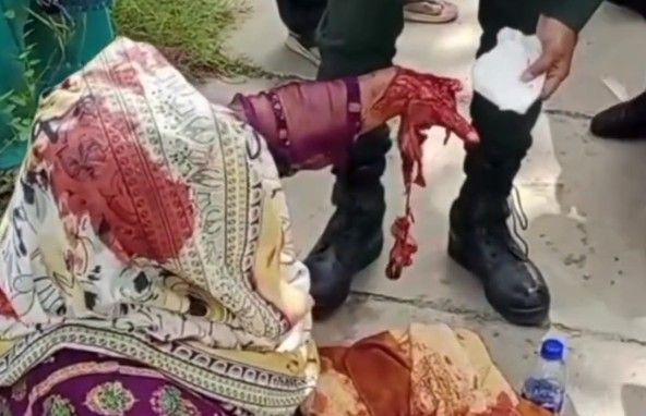 WOMAN HAND INJURED IN A TRAIN PLATFORM