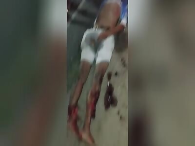 terrible accident with victim 