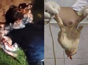 Man Lost Hand In Machete Attack 