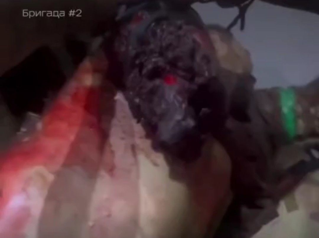 Fat Ukrat with a destroyed arm and multiple wounds.