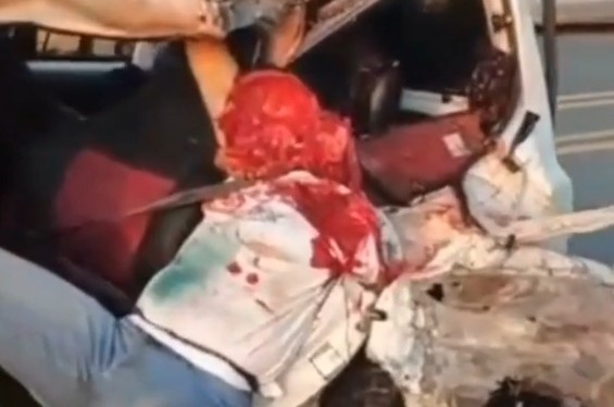 Man Lost His Half Head and Arm