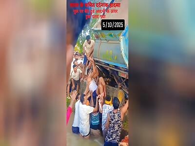 LEGS SEVERELY INJURED AFTER ACCIDENT 