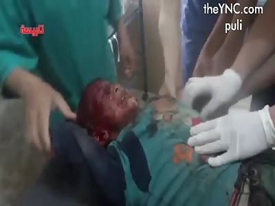 Assad airstrikes have wounded several children in Talbisah