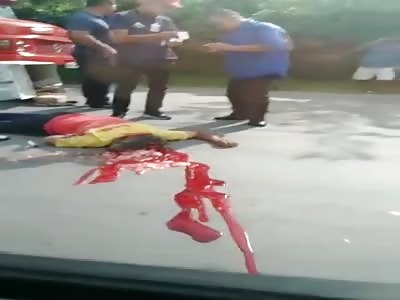 Man with his head crushed after accident
