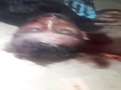 The man is beaten in AcailÃ¢ndia / Brazil