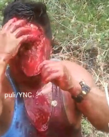 Skinned And Scalped Man in SHOCK