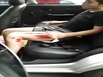 Shocking.. Thief with cut in leg