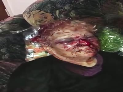 Woman victim of brutal beaten