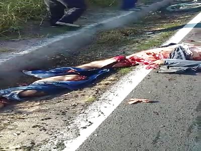 MAN' GUTS FULLY EXPOSED AFTER SHOCKING ACCIDENT