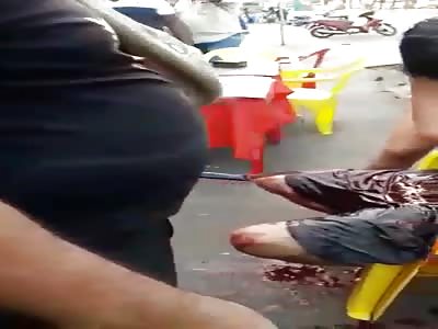 Man in agony after being stabbed