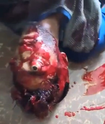 Full Gore.. Man commits suicide, head explodes.