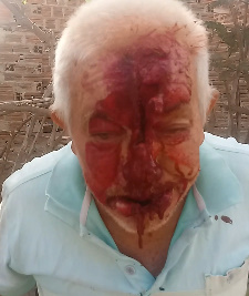 Disturbing Faceplant Aftermath