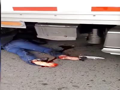 Terrible accident in which a motorcyclist loses one of his legs when being run over by a heavy vehicle.