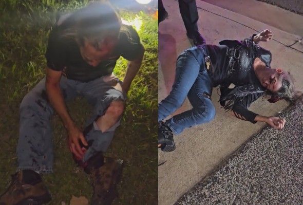 Florida Couple Critically Injured By Hit-And-Run Driver