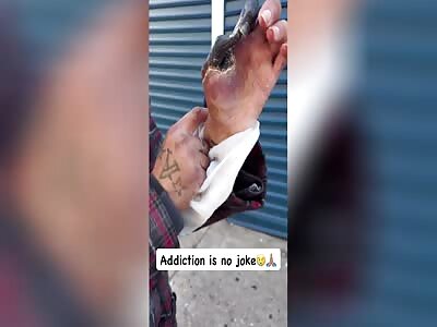 DUDE, YOUR HAND IS DEAD!