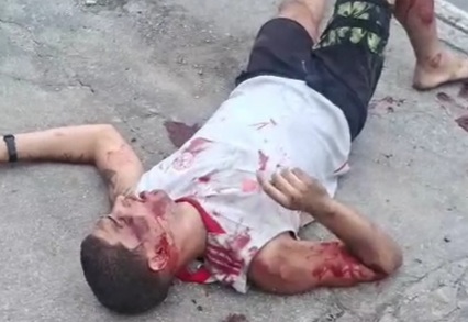 Brazilian young man victime of motorcycle accident 