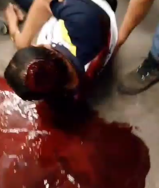 Security Guard Bleeding to Death After Attack