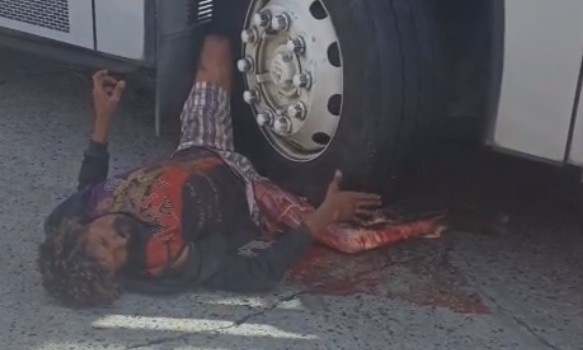 Homeless Suffers After Being Ran Over By Bus In Brazil