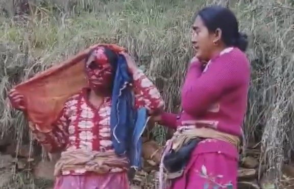 (CLEAN) Woman Attacked By Bear When She Was Collecting Grass