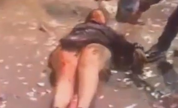 A Woman Was Shot In The Head During Festival In Colombia