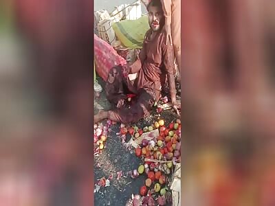 Accident leaves man with one leg