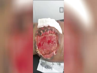 (Repost) TAKE GOOD CARE OF YOUR BUTT