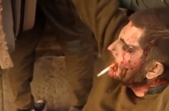 A Plea for Help From an American Journalist Hit by a Landmine.