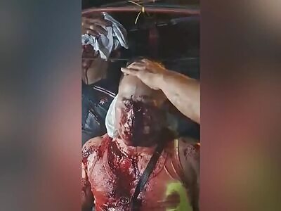 Epic accident compilation