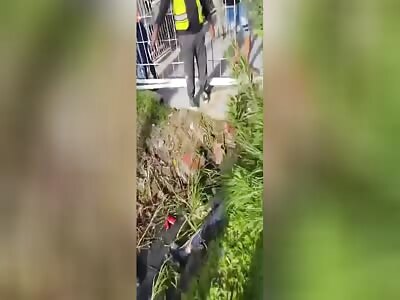 Forehead peeled back in moto accideny