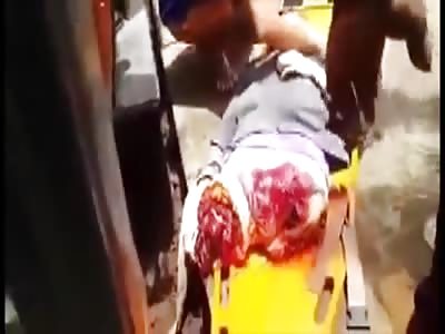 WOMAN AMPUTATES HER LEGS WITH A TRAIN (cctv Video + Aftermath)