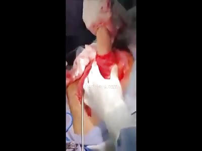 OMG.. Dildo Removal by Surgery.. LOLOLOL