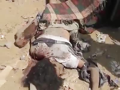 Horrible scene after Saudi attack on yemen