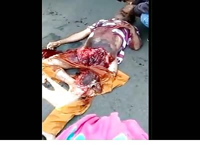 Unique Gore: Shocking accident with Man Ripped Wide Open and Hooked up to Oxygen on the Street Still Alive (Somehow) 